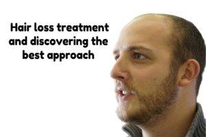 finding-a-hair-loss-treatment