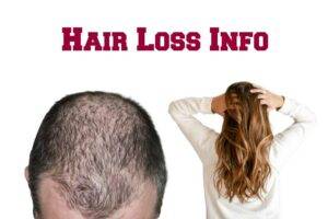 treatments-female-hair-loss