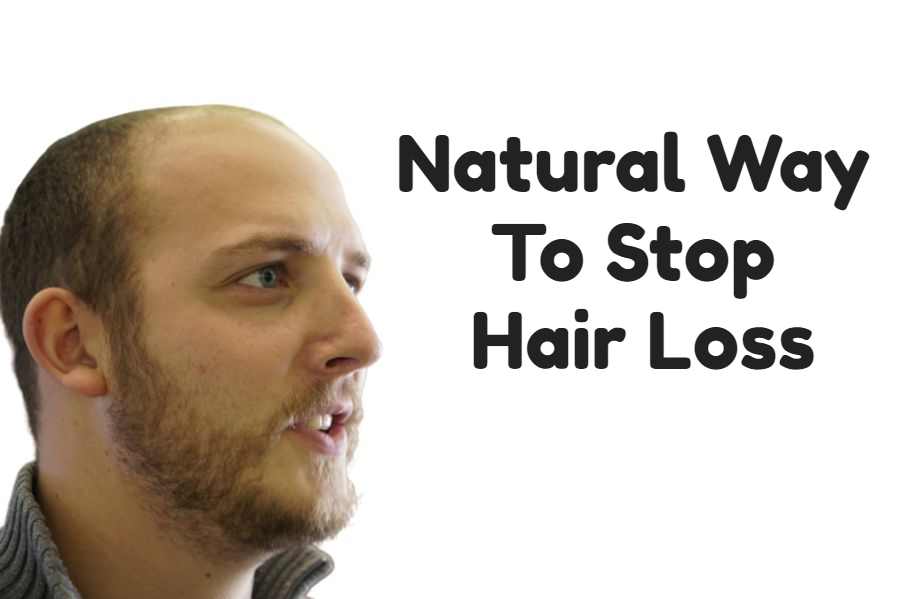 stop-hair-loss-naturally