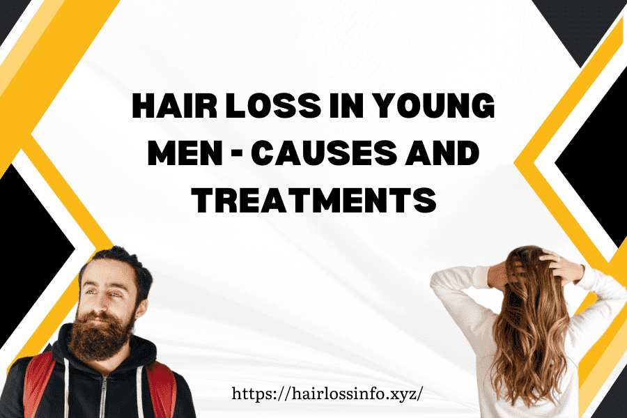 causes-hair-loss-young-men