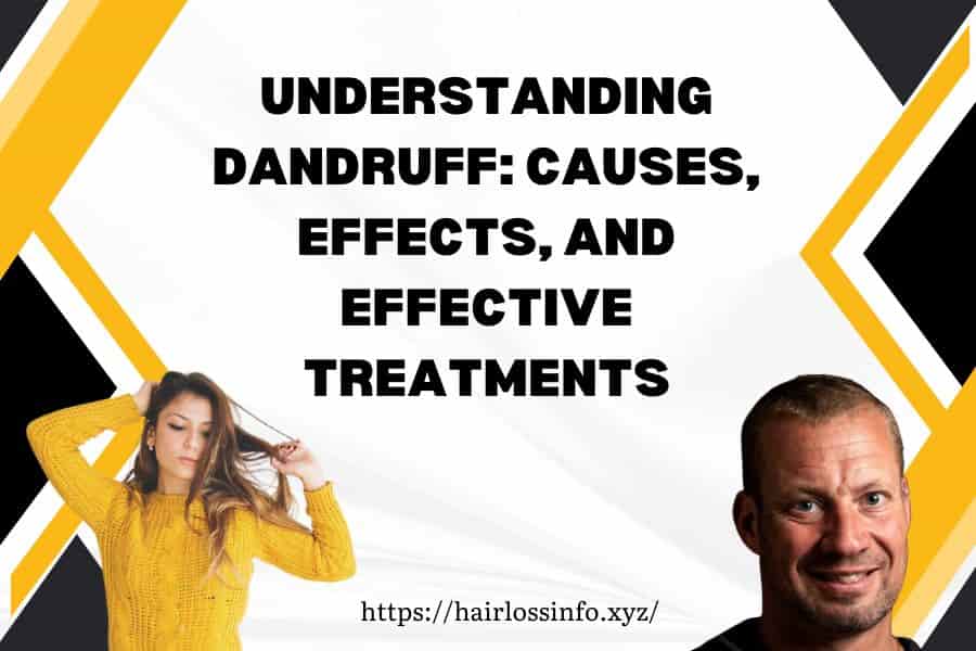 dandruff-causes-effects-treatments