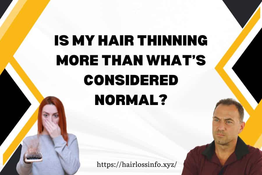 hair-thinning-more-than-considered-normal