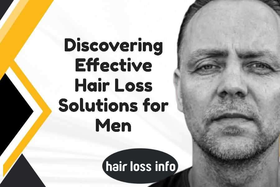 effective-hair-loss-solutions-men