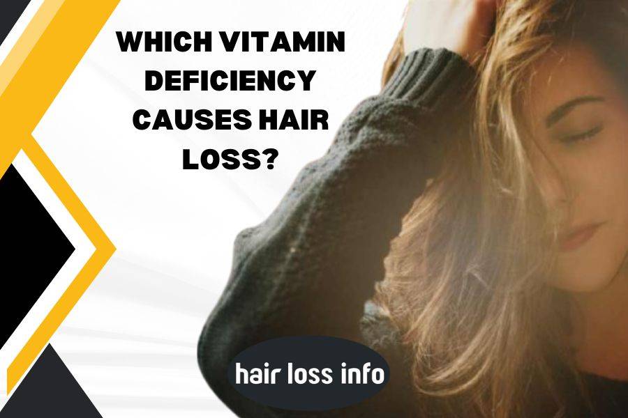 vitamin-deficiency-hair-loss